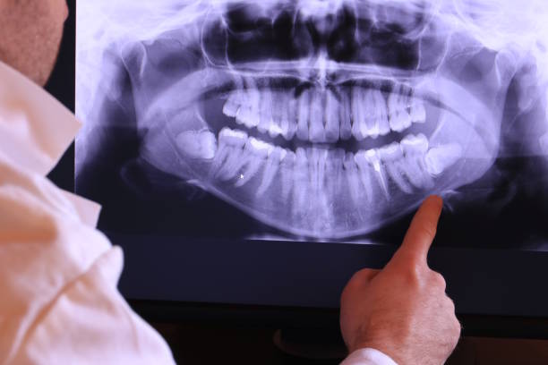 Best Emergency Root Canal Treatment in Hazardville, CT
