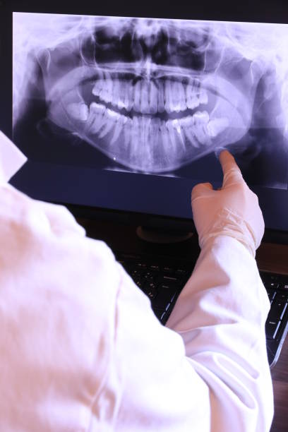 Best Emergency Wisdom Teeth Removal in Hazardville, CT